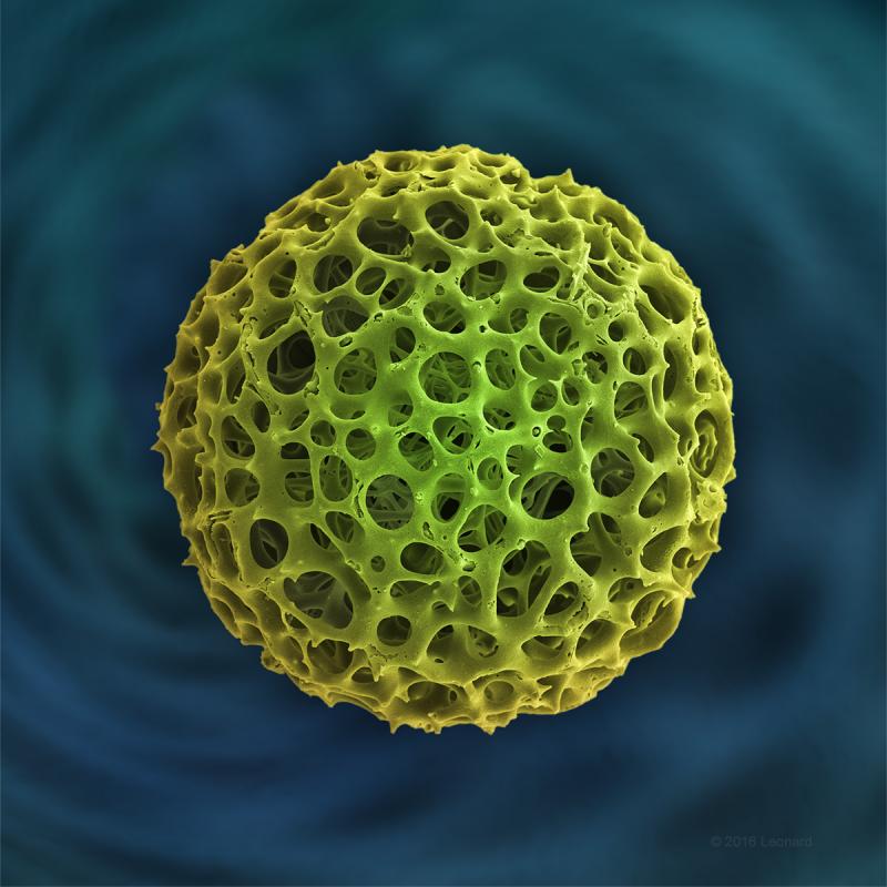 Andrew Paul Leonard Arosphaera Radiolarian Electron Microscope Photograph by Andrew Paul Leonard