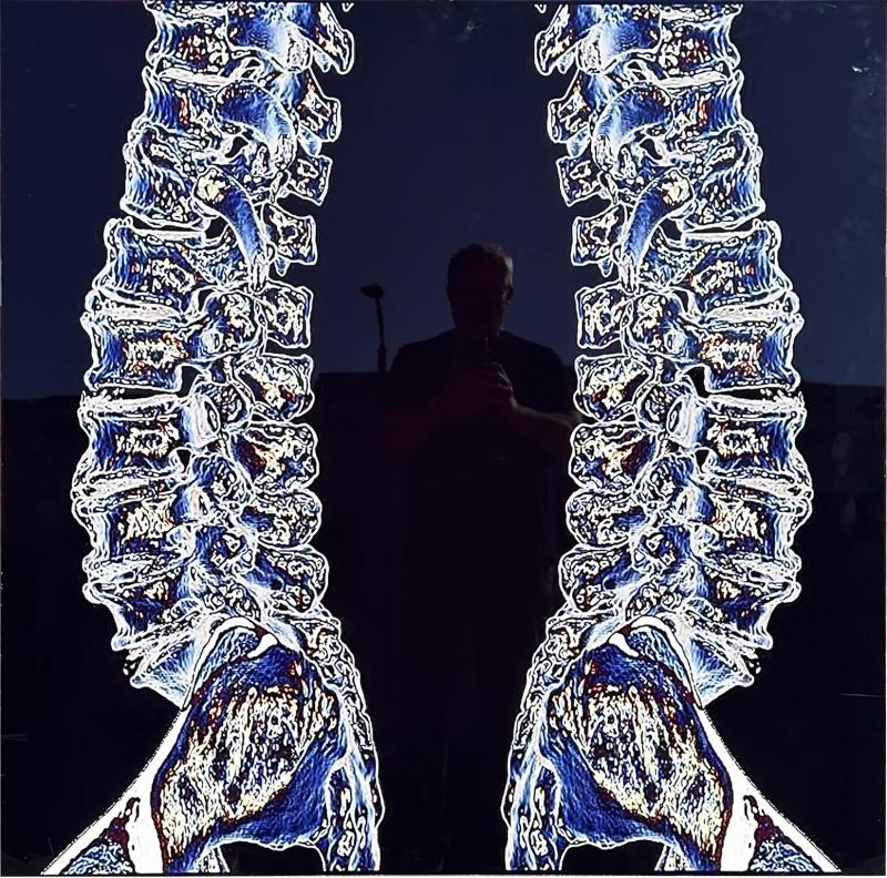 Modern Techno Skeleton Art Picture of a Spine on Aluminum