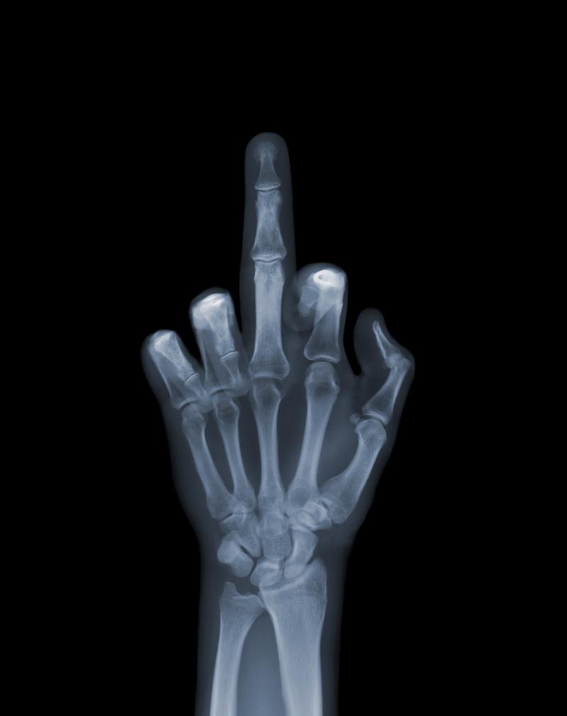 Nick Veasey The Finger