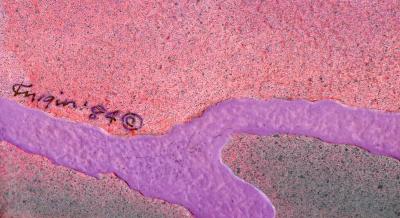 Michael Knigin Outside Choice