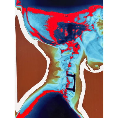 Modern Techno Skeleton Art of a Skull on Aluminum