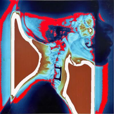 Modern Techno Skeleton Art of a Skull on Aluminum