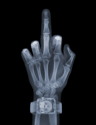 Nick Veasey Finger With Watch