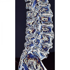 Modern Techno Skeleton Art Picture of a Spine on Aluminum - 3499711