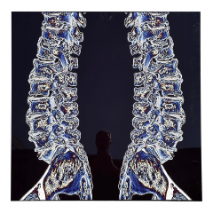 Modern Techno Skeleton Art Picture of a Spine on Aluminum - 3499727
