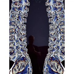 Modern Techno Skeleton Art Picture of a Spine on Aluminum - 3499735