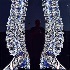 Modern Techno Skeleton Art Picture of a Spine on Aluminum - 3501690