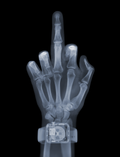 Nick Veasey Finger With Watch - 3677462