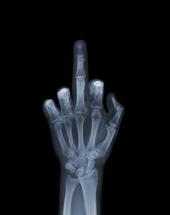 Nick Veasey The Finger - 1971292